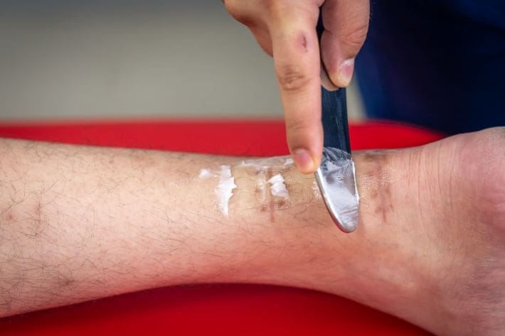 A person applying ointment to a leg wound with a metal tool.