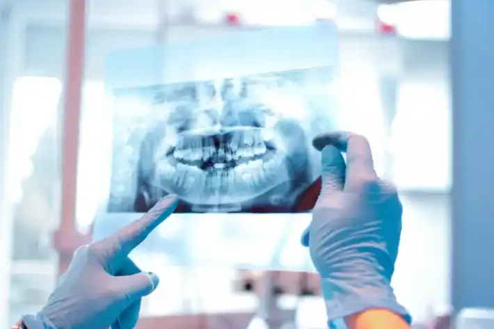 Dentist examining a dental X-ray image with gloved hands.