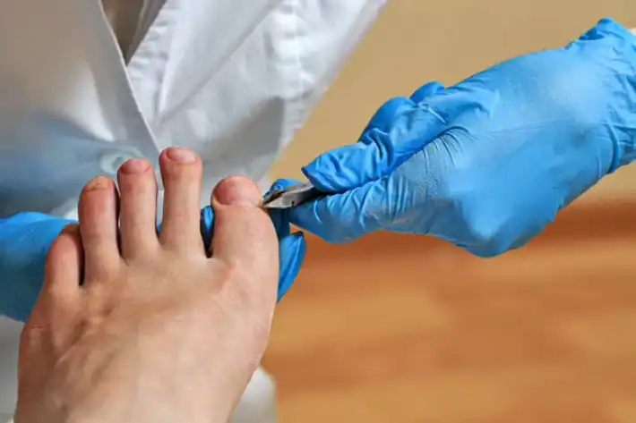 A podiatrist trimming toenails with a clipper.