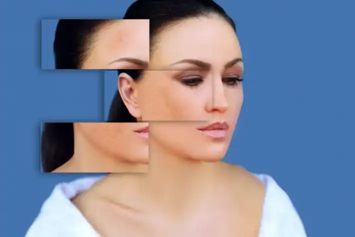 Collage of a woman's face showing different angles and features against a blue background.